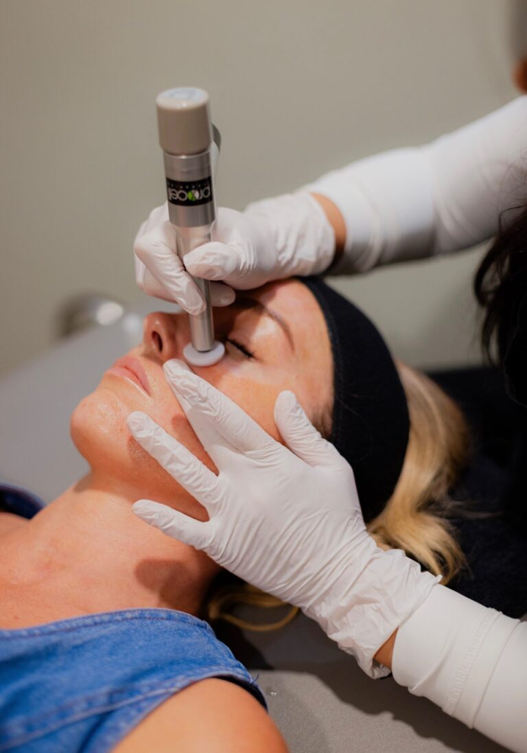 Microneedling at Saving Faces